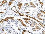 Phospho-Cytokeratin 18 (Ser53) Polyclonal Antibody
