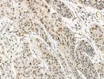 Phospho-DNMT1 (Ser714) Antibody in Immunohistochemistry (Paraffin) (IHC (P))