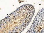 Phospho-DNMT1 (Ser714) Antibody in Immunohistochemistry (Paraffin) (IHC (P))