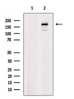 Phospho-DNMT1 (Ser714) Antibody in Western Blot (WB)