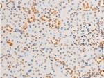 Phospho-EIF2S1 (Ser52) Antibody in Immunohistochemistry (Paraffin) (IHC (P))