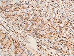 Phospho-EIF2S1 (Ser52) Antibody in Immunohistochemistry (Paraffin) (IHC (P))