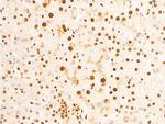 Phospho-EIF2S1 (Ser52) Antibody in Immunohistochemistry (Paraffin) (IHC (P))