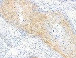Phospho-EIF4B (Ser504) Antibody in Immunohistochemistry (Paraffin) (IHC (P))