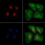 Phospho-EZH2 (Thr345) Antibody in Immunocytochemistry (ICC/IF)