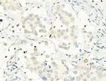 Phospho-Histone H2A.X (Ser140) Antibody in Immunohistochemistry (Paraffin) (IHC (P))
