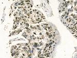 Phospho-HSP27 (Ser78) Antibody in Immunohistochemistry (Paraffin) (IHC (P))