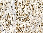 Phospho-HSP27 (Ser78) Antibody in Immunohistochemistry (Paraffin) (IHC (P))