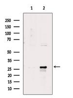 Phospho-HSP27 (Ser78) Antibody in Western Blot (WB)