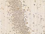 Phospho-HSP90 (Tyr627) Antibody in Immunohistochemistry (Paraffin) (IHC (P))