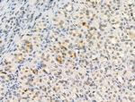 Phospho-HSP90 (Tyr627) Antibody in Immunohistochemistry (Paraffin) (IHC (P))