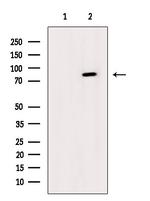 Phospho-IKK alpha/beta (Ser176, Ser180) Polyclonal Antibody