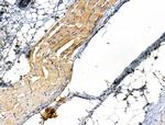 Phospho-ILK (Thr173) Antibody in Immunohistochemistry (Paraffin) (IHC (P))