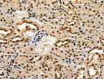 Phospho-IRF7 (Ser471, Ser472) Antibody in Immunohistochemistry (Paraffin) (IHC (P))