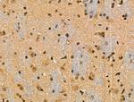 Phospho-IRF7 (Ser471, Ser472) Antibody in Immunohistochemistry (Paraffin) (IHC (P))