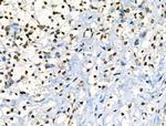 Phospho-JAK2 (Tyr1008) Antibody in Immunohistochemistry (Paraffin) (IHC (P))