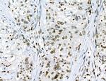 Phospho-JAK2 (Tyr1008) Antibody in Immunohistochemistry (Paraffin) (IHC (P))