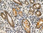 Phospho-LRRK2 (Ser910) Antibody in Immunohistochemistry (Paraffin) (IHC (P))