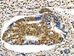 Phospho-LRRK2 (Ser910) Antibody in Immunohistochemistry (Paraffin) (IHC (P))