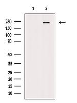 Phospho-LRRK2 (Ser910) Antibody in Western Blot (WB)