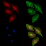 Phospho-TPL2 (Ser443) Polyclonal Antibody