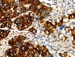 Phospho-TPL2 (Ser443) Antibody in Immunohistochemistry (Paraffin) (IHC (P))