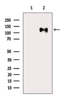 Phospho-ZCWCC1 (Ser615) Antibody in Western Blot (WB)