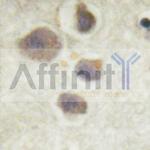 Phospho-p70 S6 Kinase (Thr252) Polyclonal Antibody