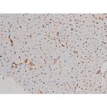 Phospho-p70 S6 Kinase (Thr252) Antibody in Immunohistochemistry (Paraffin) (IHC (P))