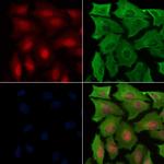 Phospho-Parkin (Ser65) Polyclonal Antibody