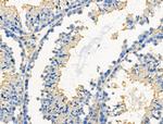 Phospho-Paxillin (Ser272) Antibody in Immunohistochemistry (Paraffin) (IHC (P))