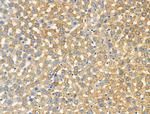 Phospho-Paxillin (Ser272) Antibody in Immunohistochemistry (Paraffin) (IHC (P))