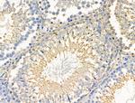 Phospho-Paxillin (Ser272) Antibody in Immunohistochemistry (Paraffin) (IHC (P))