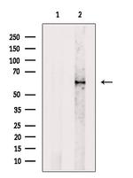 Phospho-Paxillin (Ser272) Antibody in Western Blot (WB)