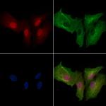 Phospho-PFKFB3 (Ser461) Polyclonal Antibody