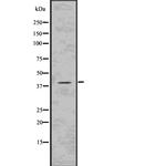 Phospho-PKA beta (Thr198) Polyclonal Antibody