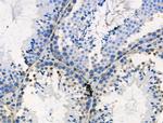 Phospho-PSD-95 (Ser418) Polyclonal Antibody
