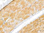 Phospho-PYGL (Ser15) Polyclonal Antibody