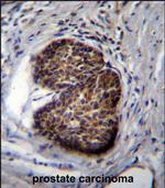 PSCA Antibody in Immunohistochemistry (Paraffin) (IHC (P))