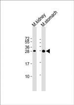 PSCA Antibody in Western Blot (WB)