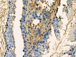Phospho-RAB29 (Ser72) Polyclonal Antibody