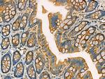 Phospho-RAB29 (Ser72) Antibody in Immunohistochemistry (Paraffin) (IHC (P))