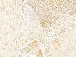 Phospho-RB1 (Ser780) Antibody in Immunohistochemistry (Paraffin) (IHC (P))