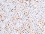 Phospho-RB1 (Ser788) Polyclonal Antibody