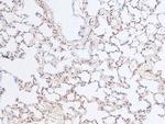 Phospho-RB1 (Ser788) Antibody in Immunohistochemistry (Paraffin) (IHC (P))