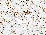 Phospho-RSK Pan (Ser221, Ser227, Ser218, Ser232) Polyclonal Antibody