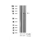 Phospho-SHP2 (Tyr542) Antibody in Western Blot (WB)