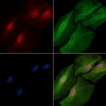 Phospho-STAT2 (Thr387) Polyclonal Antibody