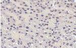 Phospho-STAT5A/B (Tyr694) Polyclonal Antibody