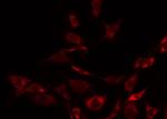 Phospho-Synaptotagmin 1/2 (Thr202) Antibody in Immunocytochemistry (ICC/IF)